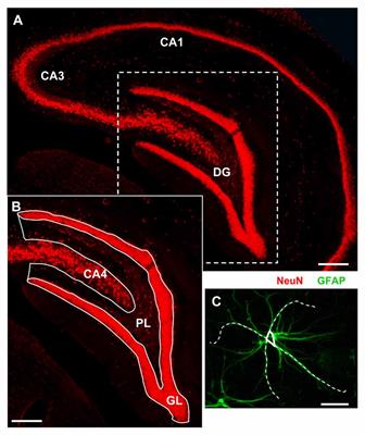 Alterations in the Interplay between Neurons, Astrocytes and Microglia in the Rat Dentate Gyrus in Experimental Models of Neurodegeneration